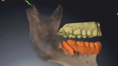 Biofunctional Dynamic Occlusion