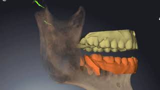 Biofunctional Dynamic Occlusion