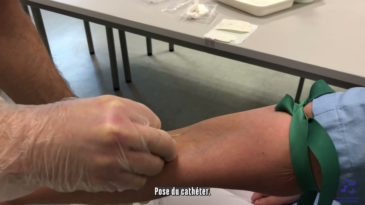 Pose de cathéter avec prolongateur.