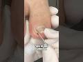 😱 Espícula pontiaguda #satisfying #nails
