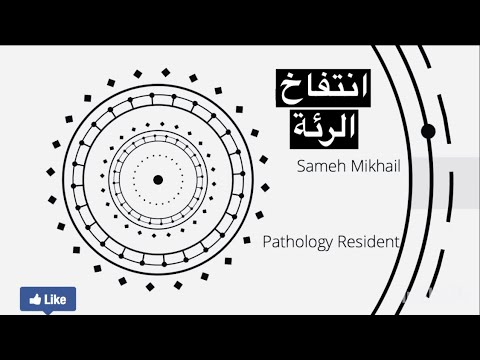 مرض انتفاخ الرئة امفيزيما و وتواجد جلطة بالرئة اضرار التدخين