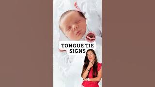 Could Your Baby Have a Tongue Tie? Key Signs to Know!