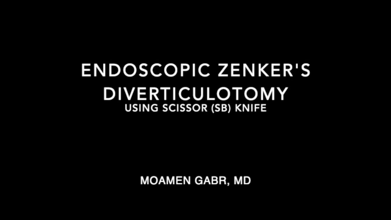 Endoscopic Zenker's Diverticulotomy YouTube