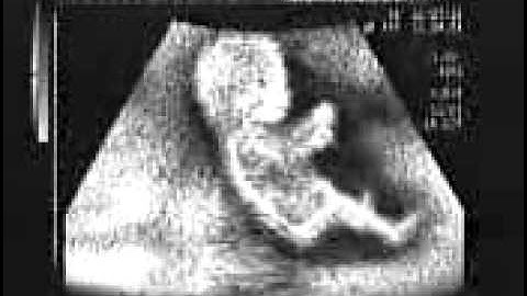 ecco cosa facevo nella pancia della mamma