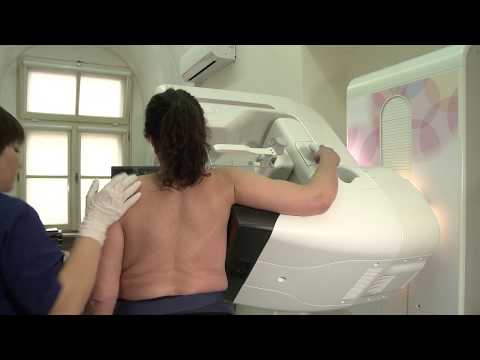 Wideo: Gęstość Mammograficzna. Pomiar Gęstości Mammograficznej