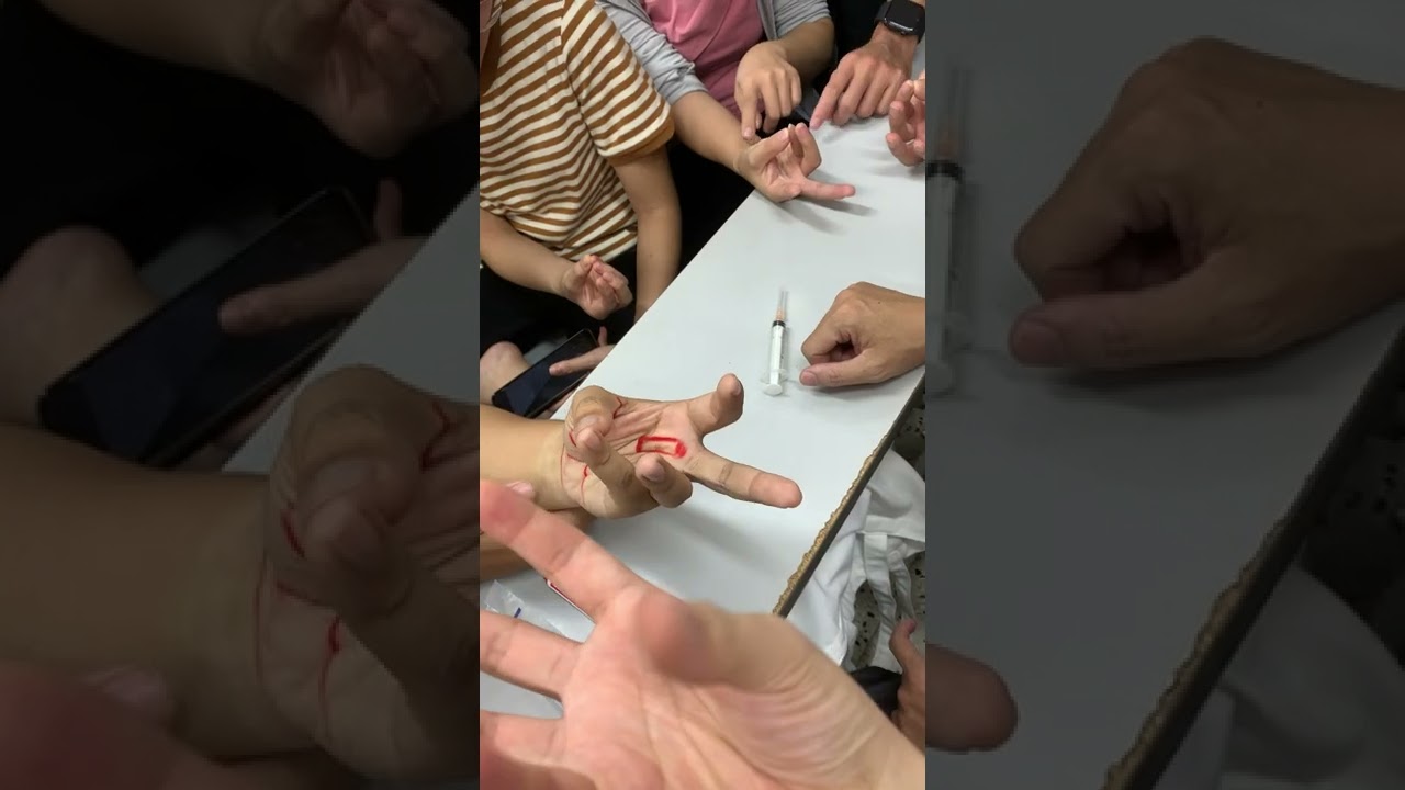 Tiêm khớp và quanh gân