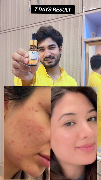 Glass skin Pilgrim vitamin c serum | pilgrim 15% vitamin c serum kaise use kare #pilgrim