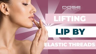 Lifting the upper lip with two elastic threads