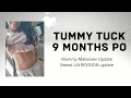 Mommy Makeover 9 months PO UPDATE- REVISION in about a week! #mommymakeover #mmo #tummytuck