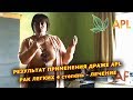 ► APLGO ✨ Рак легких. Результаты применения леденцов APL.