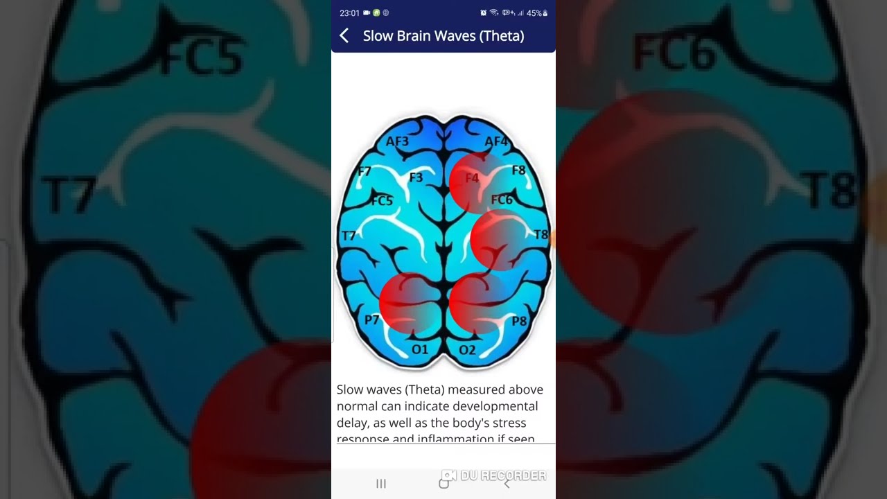 Auto  Train Brain - Reports Explained