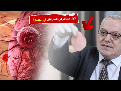 كيف يبدأ مرض السرطان في الجسم هل من الممكن الشفاء التام من السرطان افهم جسدك الوقاية من السرطان