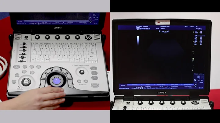 How to enter patient details on the GE logiq e ultrasound scanner and select pre-sets - video 1