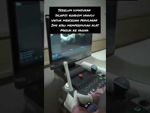 Video: Bagaimana cara kerja transduser dalam ultrasound?