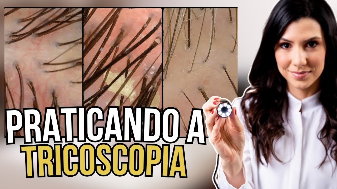 Praticando a TRICOSCOPIA: O que você vê nessas imagens?