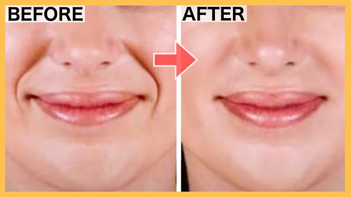 SMILE LINES Facial Exercises (Nasolabial Folds/ Laugh Lines) | Lift Smile Lines with this WORKOUT! - DayDayNews