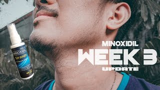 Filipino Minoxidil Beard Journey | Week 3 (Strands 6%)