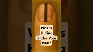 What’s Hiding Under Your Nail?
