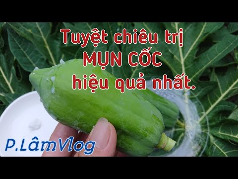 Tuyệt chiêu trị MỤN CỐC hiệu quả nhất.