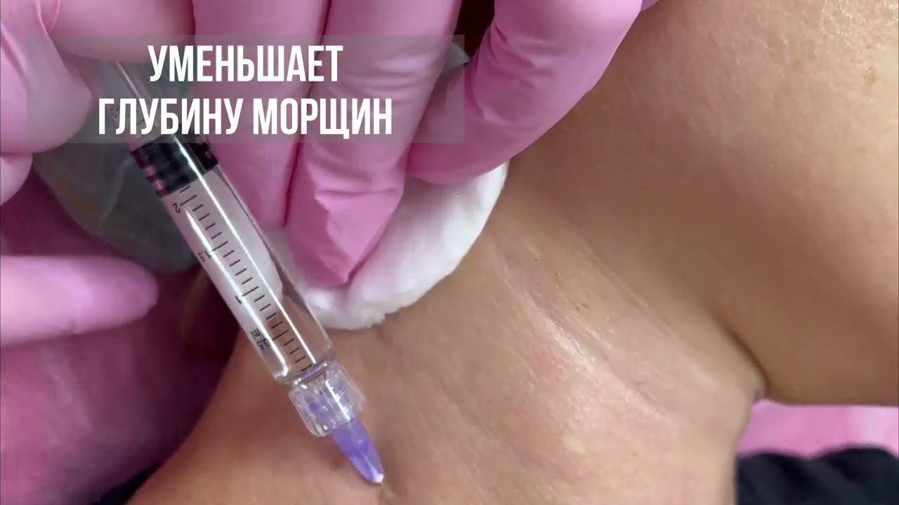 Биоревитализация янтарная кислота