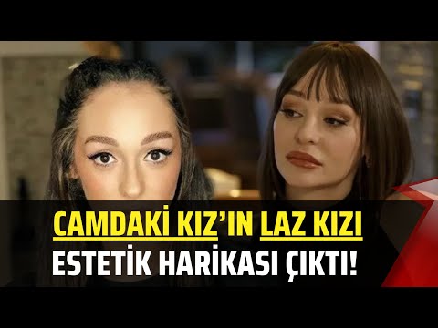 Camdaki Kız’ın Laz Kızı estetik harikası çıktı! Şarkıcı Alya'nın eski hali şoke etti!