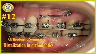 #12 Distalization in orthodontics سيمينارات تقويم الأسنان جامعة الأزهر