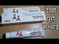 बहुत तेजी से गोरा करके दाग-धब्बे दूर करता है ये क्रीम Medisalic ointment cream review // SG support