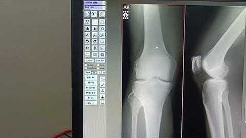 How to Use Fuji Cr XRay Setup  Complete Process ||  #xray #fuji #hospital #xraytech