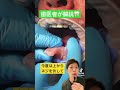 インプラントの型取り Implant 入れ歯 ブリッジ 再生医療 型どり 歯医者 Denture 歯科衛生士 歯がない インプラントの型取り Implant 入れ歯 ブリッジ 再生医療 型どり 歯医者 Denture 歯科衛生士 歯がない