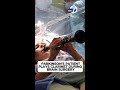Parkinson’s patient plays clarinet during brain surgery