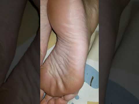 wife's rough's feet
