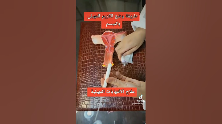 #طريقة_وضع_الكريم_المهبلي_بالمبسم#علاج_الالتهابات_المهبلية#د_فاطمة_التركي #استشاري_النساء_والولادة