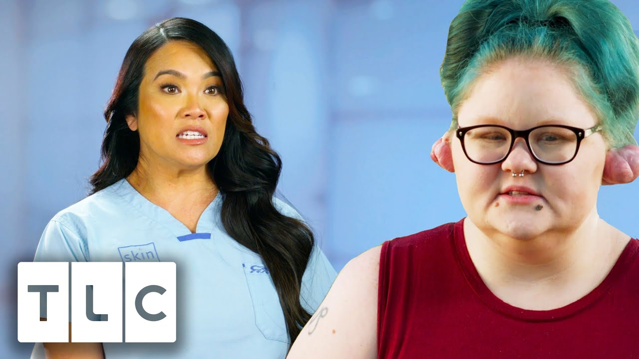 Download Woman Has Been Living With Keloids For 11 Years | Dr. Pimple Popper Pop Ups