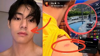 BTS V&#39;s Mustache Goes Viral! ARMYs Scream, &quot;Don&#39;t Shave It!&quot; But he&#39;s already deleted the photo.