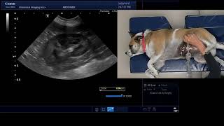 Left Kidney Complete Ultrasound Scan
