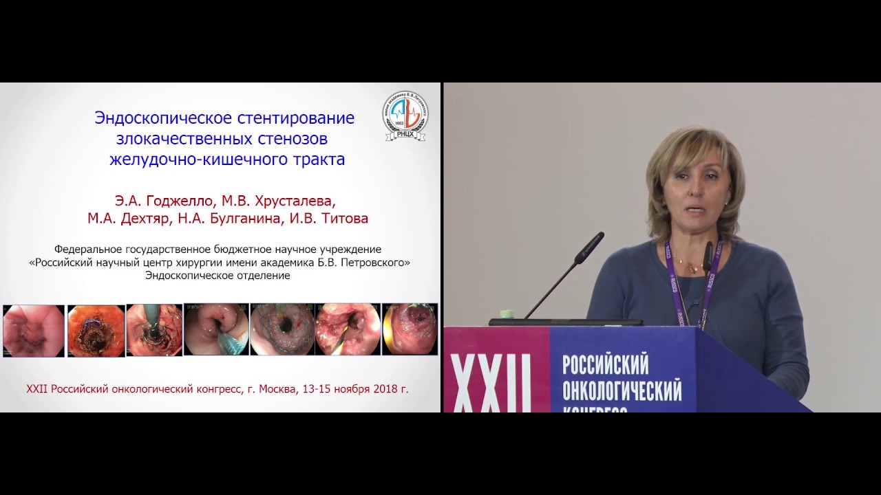 Эндоскопическое стентирование злокачественных стенозов желудочно-кишечного тракта