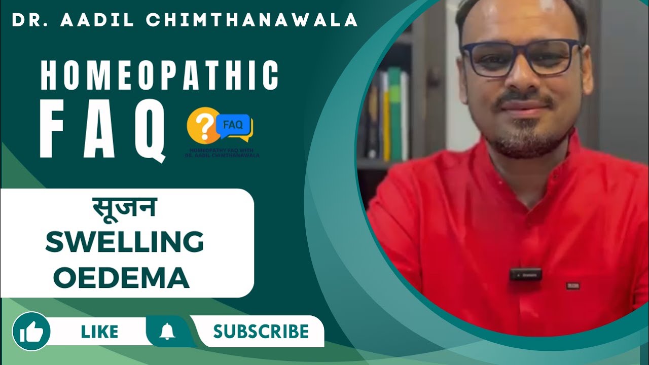 सूजन  | SWELLING | OEDEMA | Homeopathy FAQ with Dr. Aadil