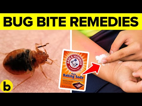 13 Natural Bug Bite Remedies That Work