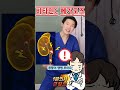 비타민C 많이 먹으면 어떻게 될까 의사가 결론만 비타민C 많이 먹으면 어떻게 될까 의사가 결론만