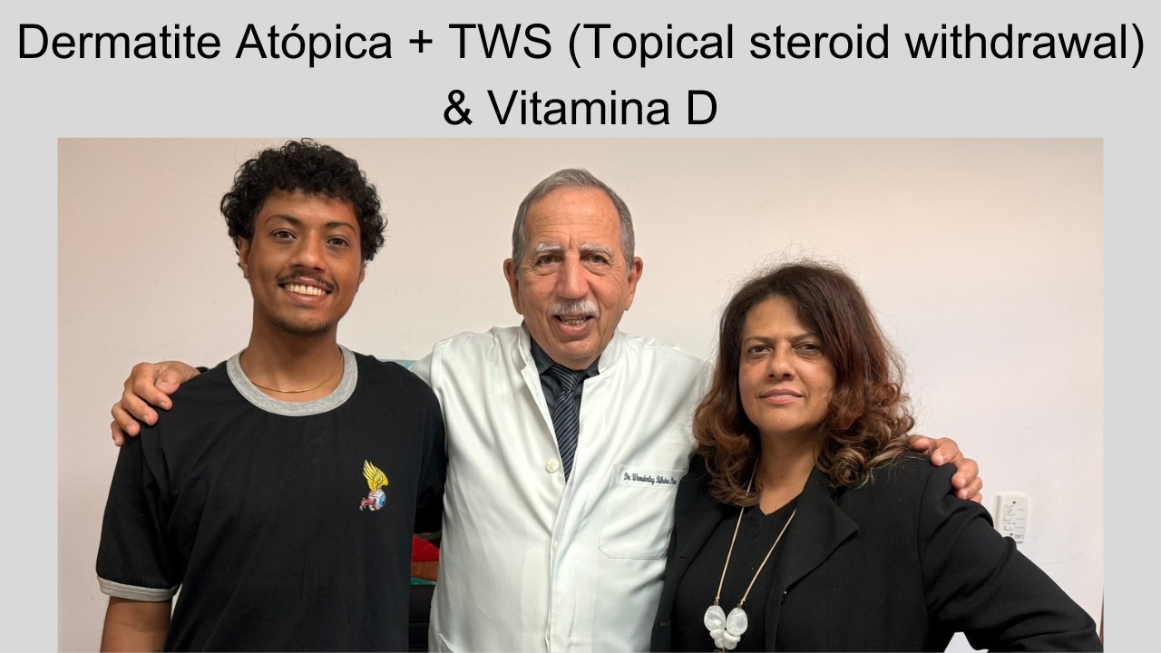 Jhonny - Dermatite Atópica + TWS (Topical steroid withdrawal) #1142