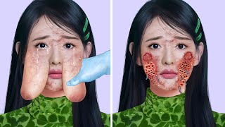 ASMR Remove Massive Facial Tumor & Worm Infected | Severely Injured Animation