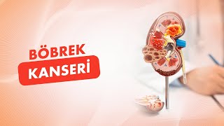 Böbrek Kanseri Nedir? Tanı Ve Tedavi Yöntemleri Nelerdir? Prof. Dr. Mehmet Fatih Akbulut