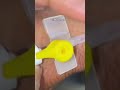 Iv cannula insertion in hand #healthcare #healthcare #cutebaby #internationallyeducatednurse #baby.