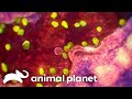 A Woman S Rare Unexplainable Organ Failure Monsters Inside Me Animal Planet A Woman S Rare Unexplainable Organ Failure Monsters Inside Me Animal Planet