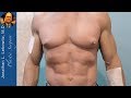 Bodybuilder Gynecomastia Surgery