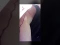 العنف ضد المرأة في السعودية العنف ضد المرأة في السعودية