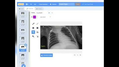 Simplify for Kids 2:Detect COVID-19 in X-ray images via the dataset using ScratchX+IBM Watson
