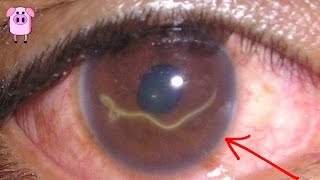 7 Most Horrifying Parasites On The Planet
