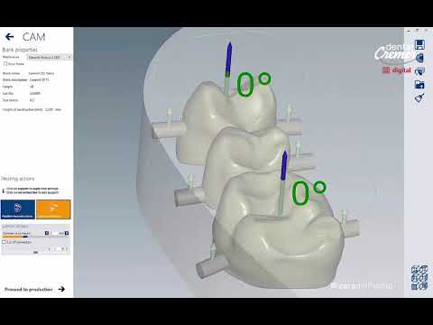 Dental Cremer Digital - Nova interface gráfica Ceramill match 2