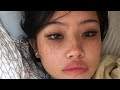 short deducted forehead { 1X LISTEN }
